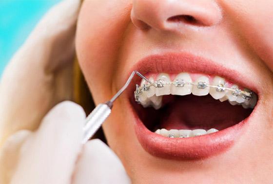 good orthodontist in dubai