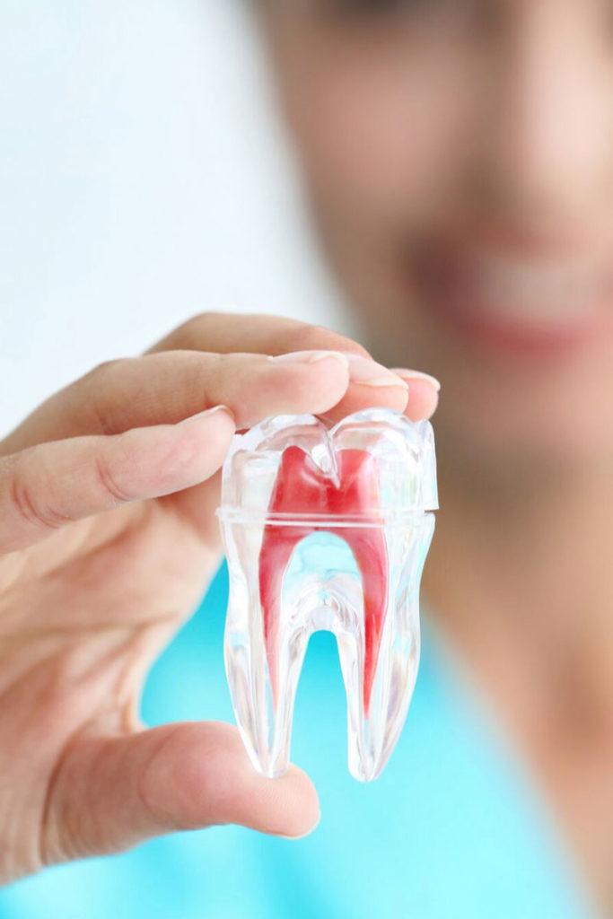 root canal treatment cost dubai