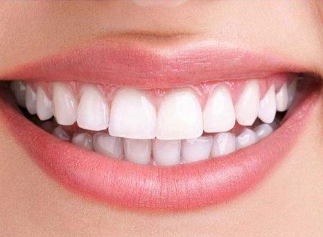 international-city-dental-clinic international-city-dental-clinic