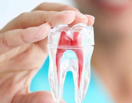 root canal treatment cost dubai