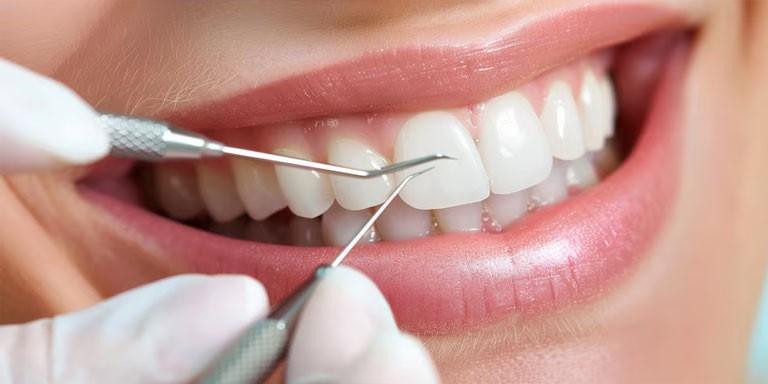 Invisalign braces cost