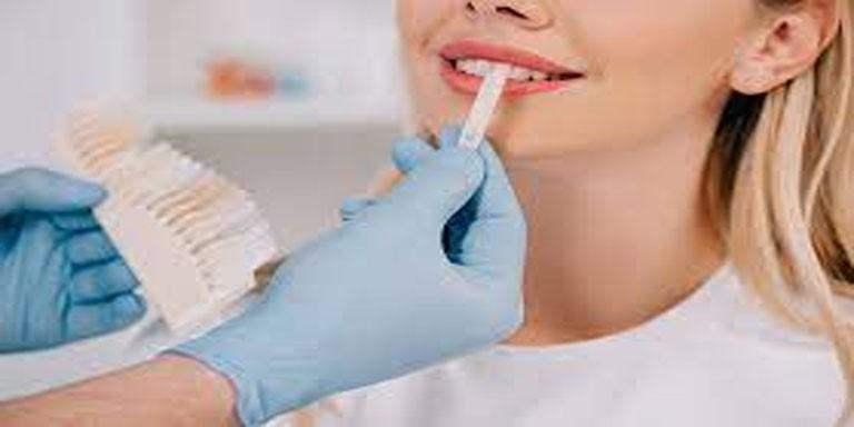 wisdom tooth removal cost in Dubai