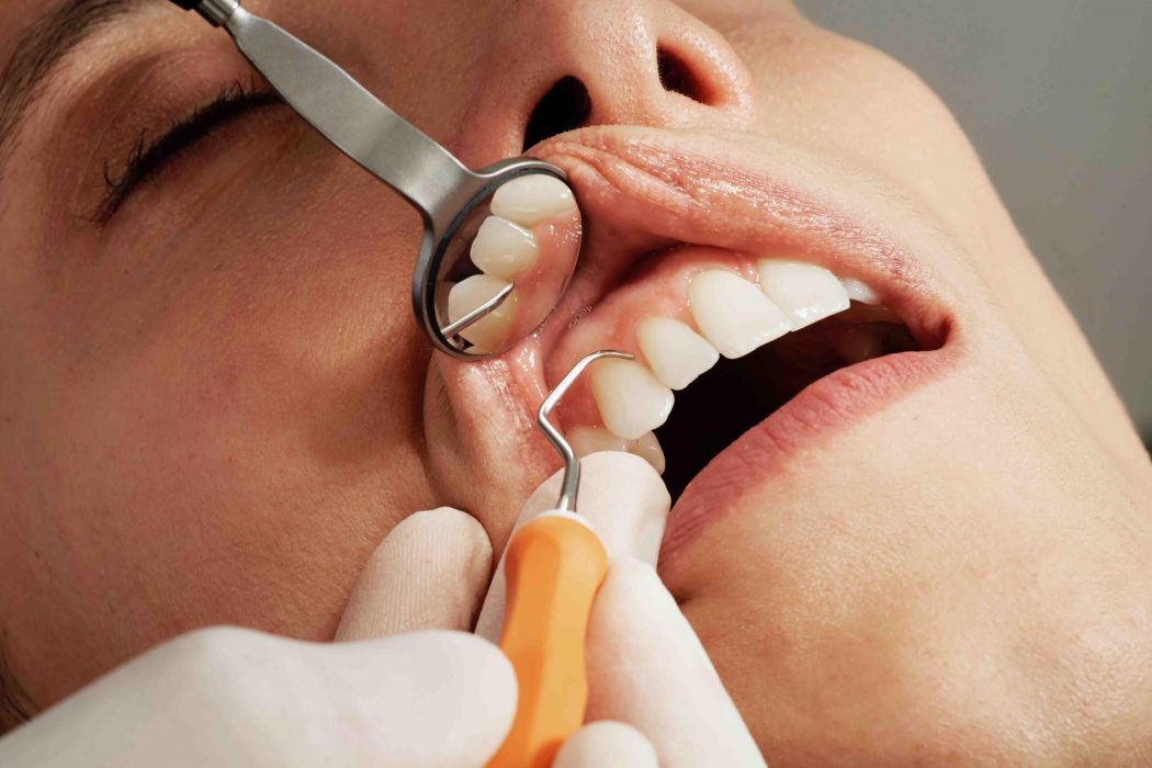 Cosmetic Dental Clinic Dubai