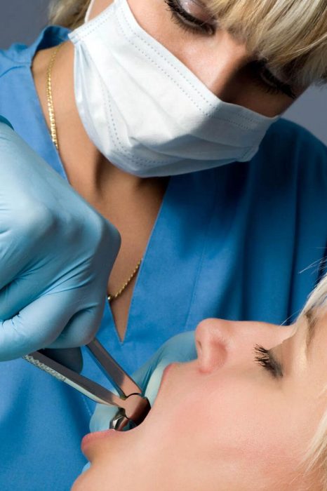 tooth extraction in dubai