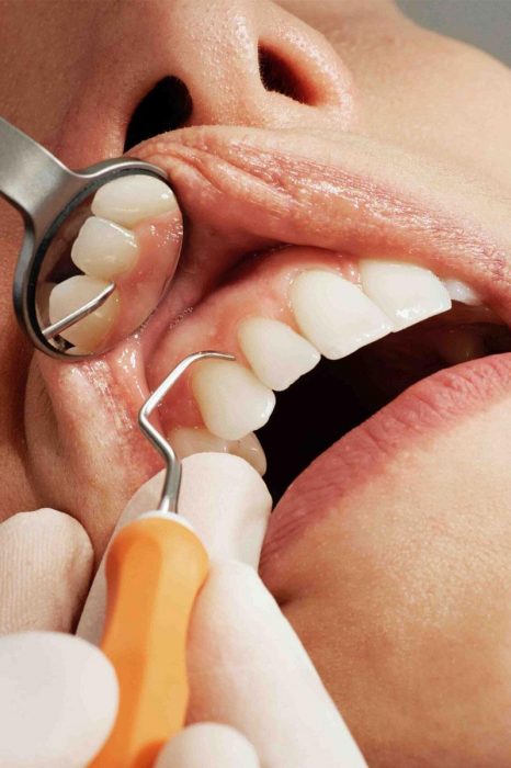 Cosmetic Dental Clinic Dubai